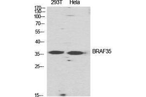 Western Blot (WB) analysis of specific cells using BRAF35 Polyclonal Antibody. (HMG20B Antikörper  (N-Term))