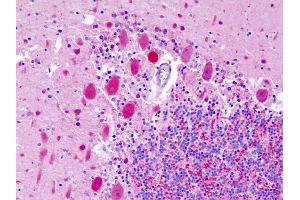 Anti-UCHL1 / PGP9. (UCHL1 Antikörper  (AA 187-214))