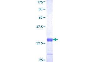 MEX3D Protein (AA 418-488) (GST tag)