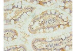 Immunohistochemistry of paraffin-embedded human small intestine tissue using ABIN7170170 at dilution of 1:100 (SLC23A1 Antikörper  (AA 173-259))