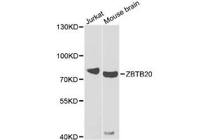 Western blot analysis of extracts of various cell lines, using ZBTB20 antibody. (ZBTB20 Antikörper)