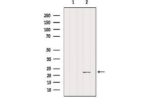 Western blot analysis of extracts from Mouse muscle, using SAR1A Antibody. (SAR1A Antikörper  (Internal Region))