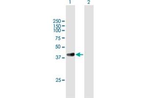 Western Blot analysis of GRAP2 expression in transfected 293T cell line by GRAP2 MaxPab polyclonal antibody. (GRAP2 Antikörper  (AA 1-330))