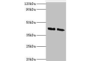Western blot All lanes: COPS4 antibody at 8 μg/mL Lane 1: Hela whole cell lysate Lane 2: HepG2 whole cell lysate Secondary Goat polyclonal to rabbit IgG at 1/10000 dilution Predicted band size: 47, 41 kDa Observed band size: 47 kDa (COPS4 Antikörper  (AA 1-310))
