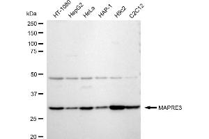 Western blotting analysis using MAPRE3 antibody (ABIN7799412).