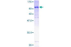 Image no. 1 for Guanylate Cyclase 1, Soluble, beta 3 (GUCY1B3) (AA 1-619) protein (GST tag) (ABIN1306218)