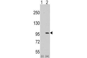 Western blot analysis of DDR1 antibody and 293 cell lysate (2 ug/lane) either nontransfected (Lane 1) or transiently transfected with the DDR1 gene (2). (DDR1 Antikörper  (AA 299-330))
