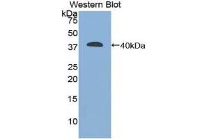 Detection of Recombinant GFAP, Mouse using Polyclonal Antibody to Glial Fibrillary Acidic Protein (GFAP) (GFAP Antikörper  (AA 253-354))