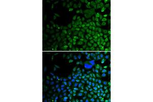 Immunofluorescence analysis of A549 cells using HDAC2 antibody. (HDAC2 Antikörper  (C-Term))