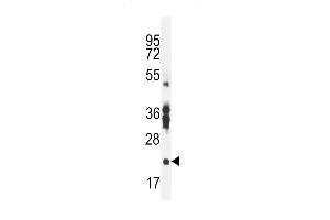 RBS2 Antibody (Center) (ABIN656055 and ABIN2845413) western blot analysis in mouse stomach tissue lysates (35 μg/lane). (RBPMS2 Antikörper  (AA 113-141))