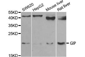 Western blot analysis of extracts of various cell lines, using GIP antibody. (GIP Antikörper)