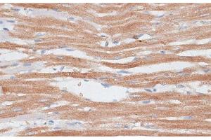 Immunohistochemistry of paraffin-embedded Rat heart using KATNA1 Polyclonal Antibody at dilution of 1:100 (40x lens).