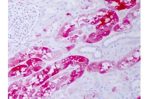 Anti-CRYAB / Alpha B Crystallin antibody IHC of human kidney.