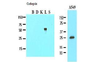 Western Blotting (WB) image for anti-Cathepsin L1 (CTSL1) (AA 114-333) antibody (ABIN317509) (Cathepsin L Antikörper  (AA 114-333))