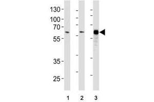 HDAC1 antibody western blot analysis in (1) HeLa, (2) WiDr, and (3) Jurkat lysate.