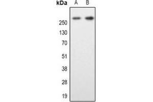 Western blot analysis of MAP2 expression in SKNSH (A), mouse brain (B) whole cell lysates. (MAP2 Antikörper  (N-Term))