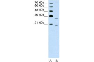 Western Blotting (WB) image for anti-Deoxyribonuclease II beta (DNASE2B) antibody (ABIN2462609) (DNASE2B Antikörper)