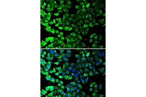 Immunofluorescence (IF) image for anti-Keratin 8 (KRT8) (AA 1-483) antibody (ABIN3021288)
