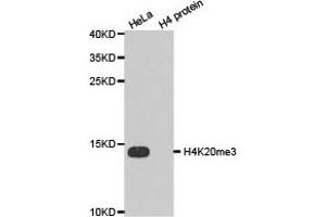 Western blot analysis of extracts of HeLa cell line and H4 protein expressed in E. (Histone 3 Antikörper  (3meLys20))