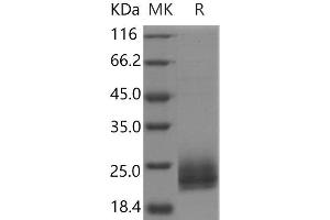 Western Blotting (WB) image for Niemann-Pick Disease, Type C2 (NPC2) protein (His tag) (ABIN7321066)