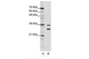 Image no. 1 for anti-Methenyltetrahydrofolate Synthetase Domain Containing (MTHFSD) (AA 60-109) antibody (ABIN202358) (MTHFSD Antikörper  (AA 60-109))