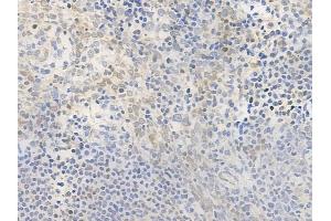 ABIN6261464 and ABIN6276554 at 1/100 staining human normal tonsil tissue by IHC-P.