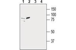 SLC39A6 Antikörper  (Extracellular, N-Term)