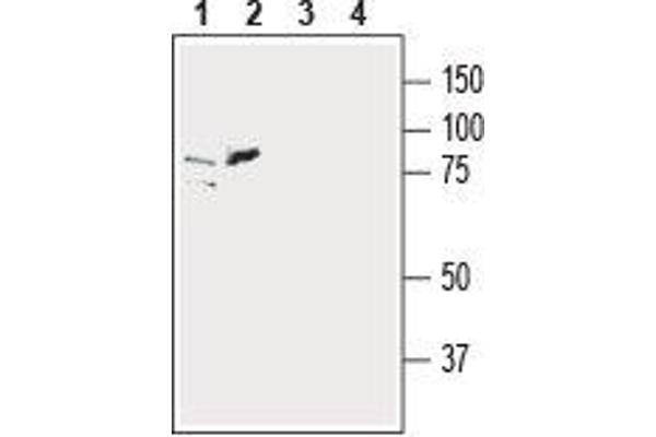 SLC39A6 Antikörper  (Extracellular, N-Term)