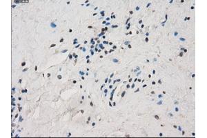 Immunohistochemical staining of paraffin-embedded Ovary tissue using anti-FCGR2A mouse monoclonal antibody. (FCGR2A Antikörper)