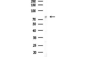 anti-Choroideremia-Like (Rab Escort Protein 2) (CHML) (Internal Region) antibody