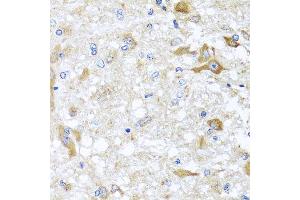 Immunohistochemistry of paraffin-embedded rat brain using ABCB8 antibody at dilution of 1:100 (x40 lens). (ABCB8 Antikörper)