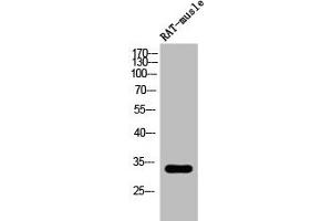 Western Blot analysis of RAT-musle cells using Phospho-DARPP-32 (T34) Polyclonal Antibody (DARPP32 Antikörper  (pThr34))