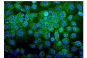 IF analysis of CDC123 using anti-CDC123 antibody (ABIN7599284).