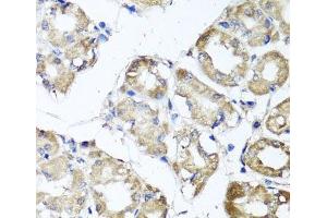 Immunohistochemistry of paraffin-embedded Human stomach using MGAT1 Polyclonal Antibody at dilution of 1:100 (40x lens). (MGAT1 Antikörper)