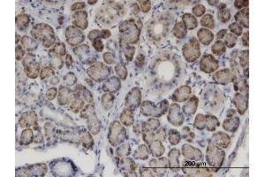 Immunoperoxidase of monoclonal antibody to MSRA on formalin-fixed paraffin-embedded human salivary gland. (MSRA Antikörper  (AA 1-100))