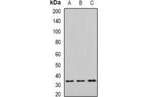 Western blot analysis of eIF2B1 expression in SHSY5Y (A), MCF7 (B), mouse liver (C), mouse brain (D) whole cell lysates. (EIF2B1 Antikörper)