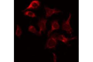 ABIN6269033 staining COS7 by IF/ICC. (TYR Antikörper)
