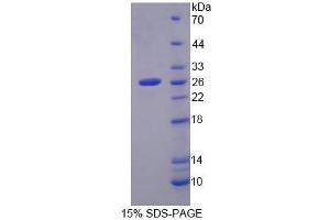 SDS-PAGE analysis of Mouse MCCC2 Protein.