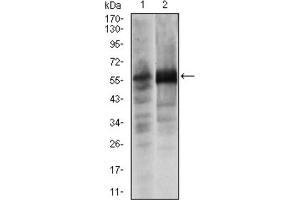 Western blot analysis using SOX9 antibody against Lovo (1) and SW620 (2) cell lysate.