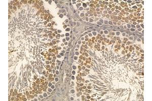 Phospho-E2F1 (Thr433) Mouse Monoclonal Antibody at 1/100 staining rat testis tissue by IHC-P. (E2F1 Antikörper  (pThr433))