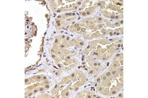 Immunohistochemistry of paraffin-embedded human kidney using RPS5 antibody at dilution of 1:100 (x400 lens). (RPS5 Antikörper)