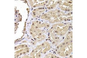 Immunohistochemistry of paraffin-embedded human kidney using RPS5 antibody at dilution of 1:100 (x400 lens).