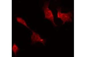 ABIN6277246 staining HepG2 by IF/ICC. (TNK2 Antikörper  (C-Term))