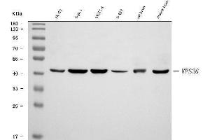Western blot analysis of VPS36 using anti-VPS36 antibody (ABIN7599339).