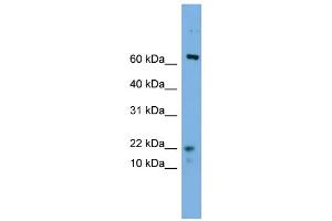WB Suggested Anti-YPEL5 Antibody Titration: 0.