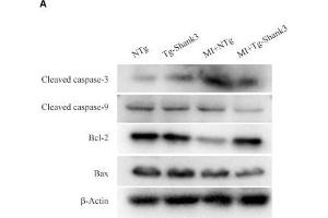 Shank3 overexpression inhibits cardiomyocytes apoptosis. (Caspase 9 Antikörper  (AA 1-98))