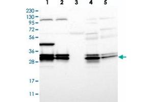 Western blot analysis of Lane 1: RT-4, Lane 2: U-251 MG, Lane 3: Human Plasma, Lane 4: Liver, Lane 5: Tonsil with PGAM5 polyclonal antibody  at 1:500-1:1000 dilution.