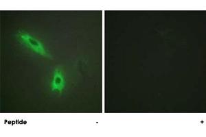 Immunofluorescence analysis of HeLa cells, using LTB polyclonal antibody . (LTB Antikörper  (C-Term))