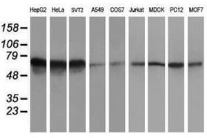 Image no. 2 for anti-5-Aminoimidazole-4-Carboxamide Ribonucleotide Formyltransferase/IMP Cyclohydrolase (ATIC) antibody (ABIN1496505) (ATIC Antikörper)