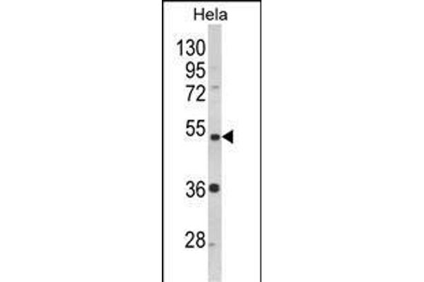 PPP2R2B Antikörper  (AA 104-130)